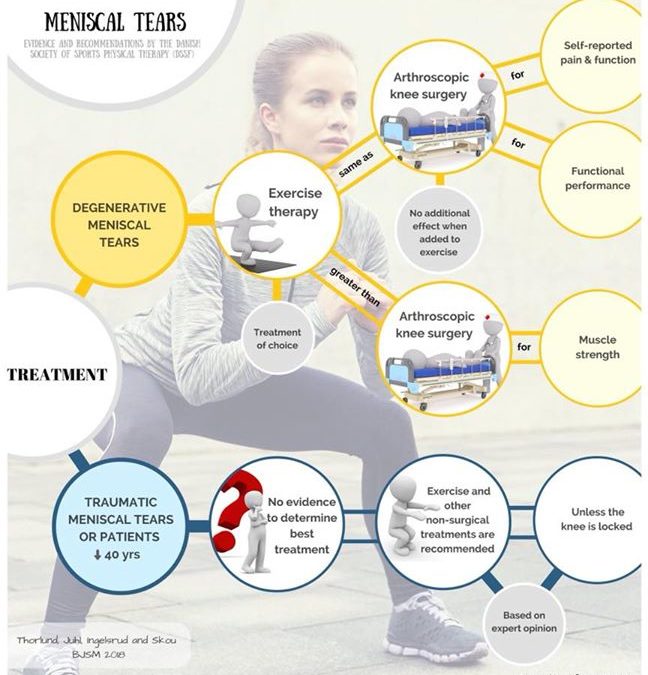 “Exercise therapy should be recommended as the treatment of choice for middle-aged and older patients with degenerative meniscal